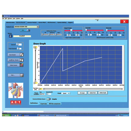 دوچرخه بازتوانی